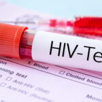 HIV test